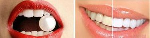花生真的能美白牙齿吗？