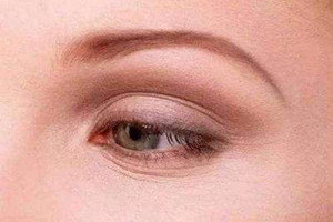 眼纹类型有哪些？