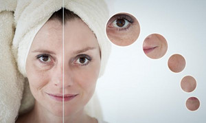 左脸长痘的原因是什么 简单四招护肤措施让你变回水嫩皮肤
