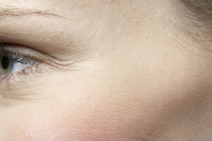 眼睛皺紋多皮膚松弛怎么改善 四招護膚措施幫你解決困擾
