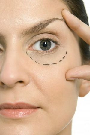 如何去除脂肪粒眼睛周围 详解几大超有效的方法