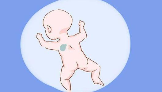 刚刚出生的宝宝身上有这几种胎记父母需要注意了